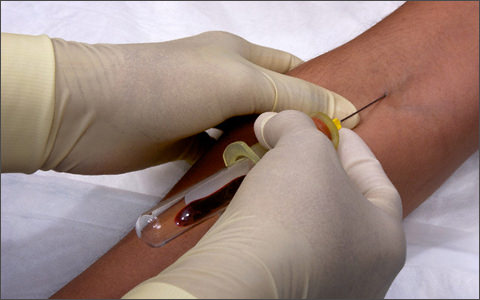 Как определить, курит&nbsp;ли человек?