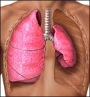 Спонтанный пневмоторакс