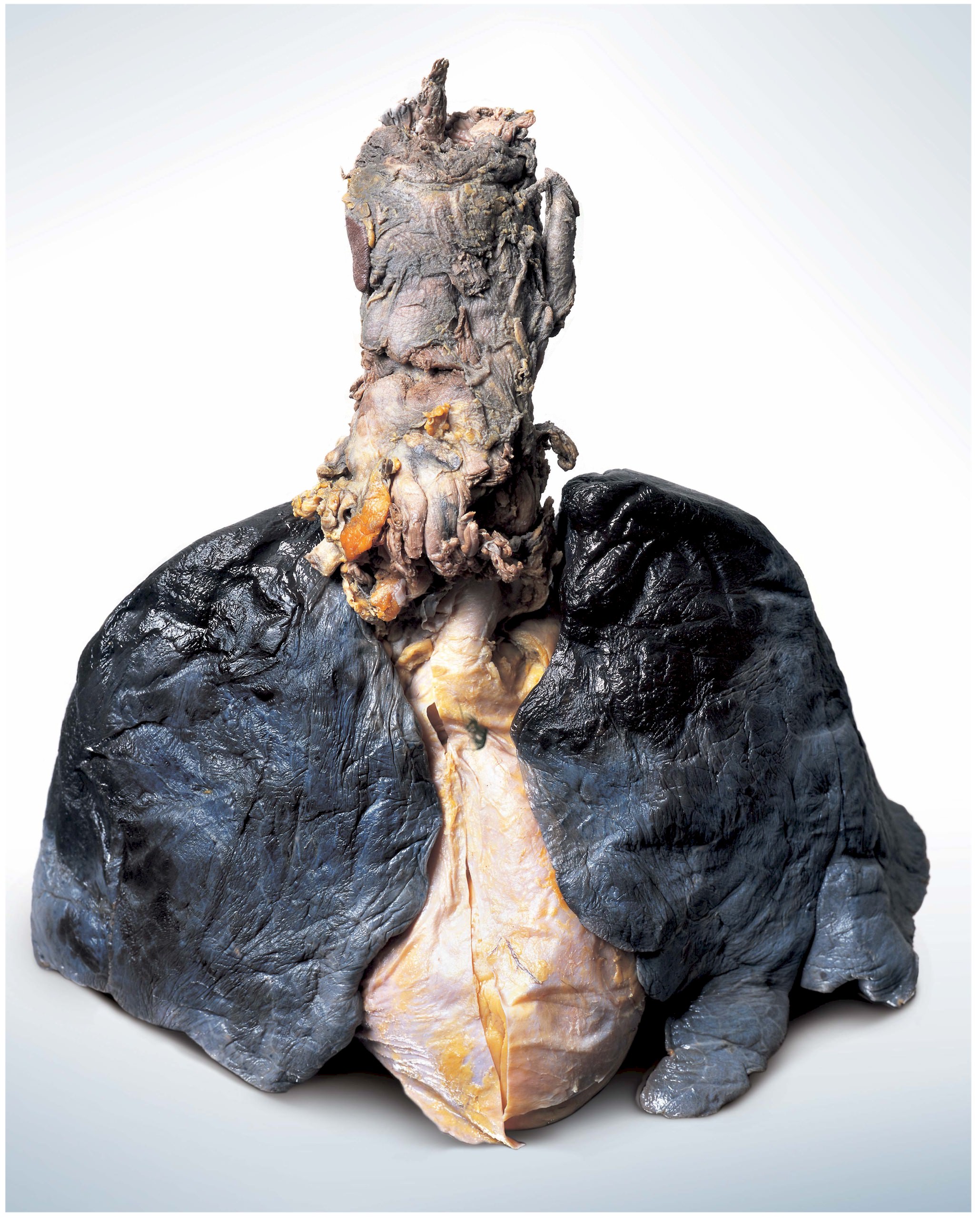 Легкие курильщика