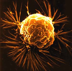 4 февраля - Всемирный день борьбы с раковыми заболеваниями