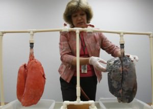 Легкие бросившего курить