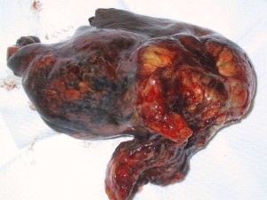 Курение вредит здоровью