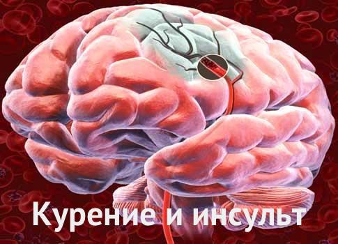 Курение и инсульт