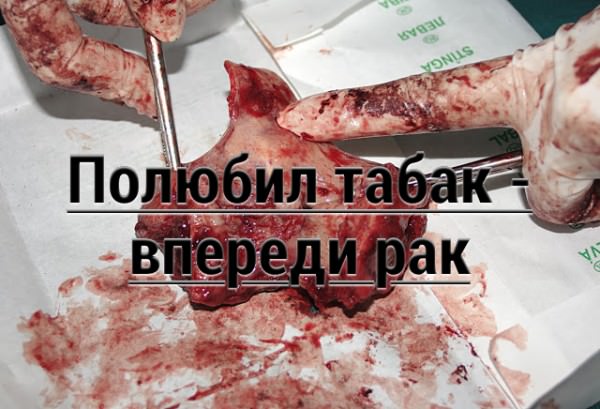 Полюбил табак - впереди рак