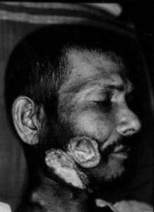 Мутационные процессы возникают благодаря курению