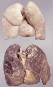 Очищение легких после курения