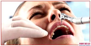 Бросил курить - болят зубы