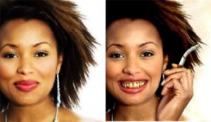 Почему от курения желтеют зубы